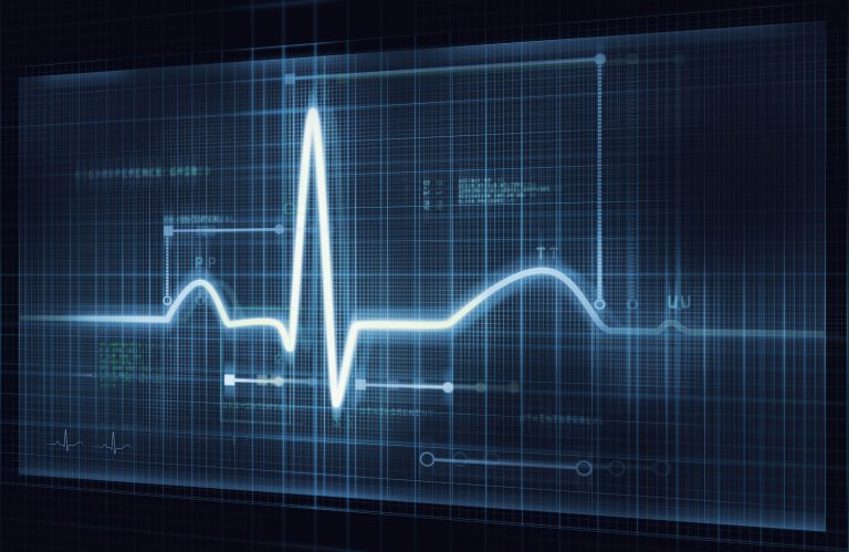 Technoloty News :  CardioComm, a provider of ECG monitoring devices, confirms cyberattack downed its services .